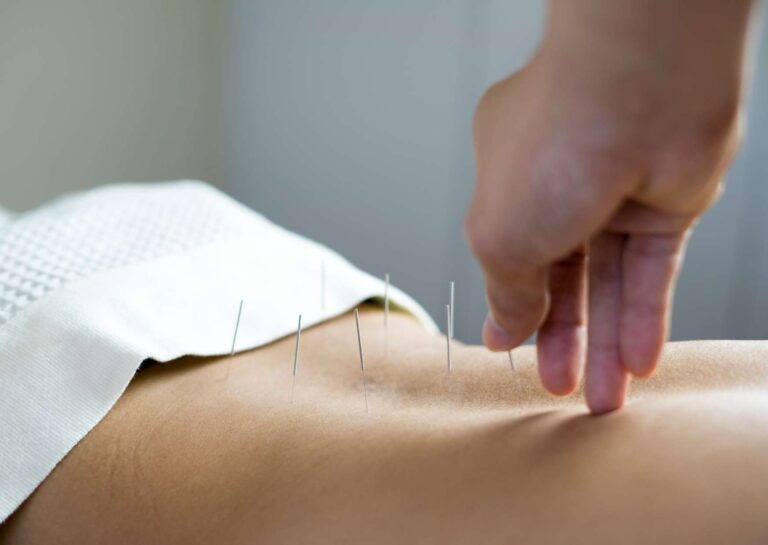 Diploma in Acupuncture Practice